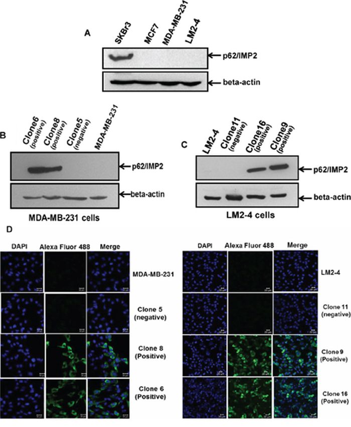 The generation of variants with stable overexpression of p62/IMP2 in breast cancer cells.