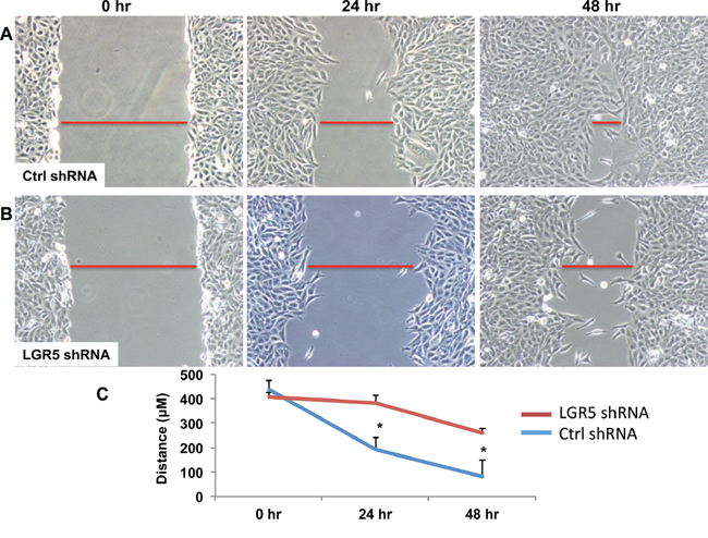 shRNA-mediated decrease in LGR5 expression results in inhibition of cell migration.