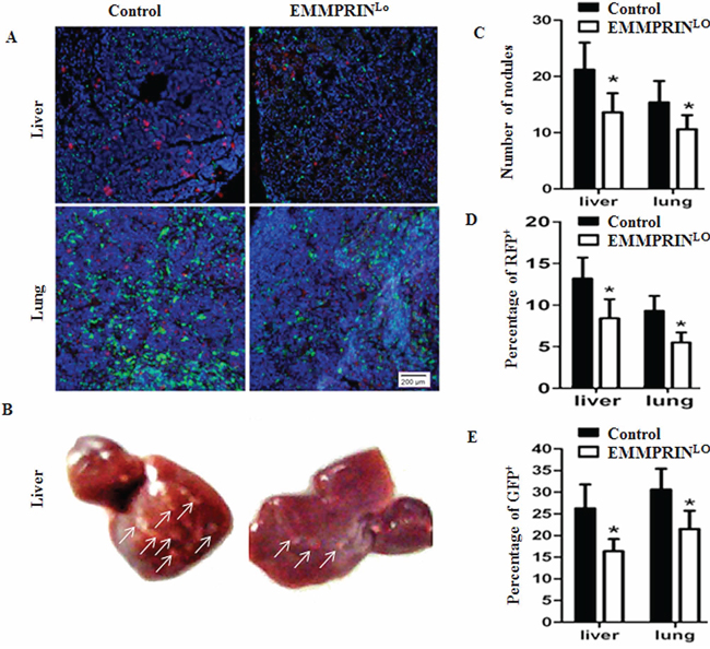 Down-regulation of EMMPRIN reduces tumor metastasis and BMDC recruitment.