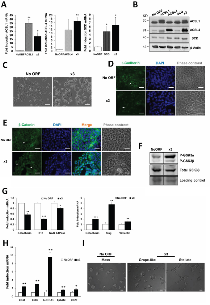ACSL1, ACSL4 and SCD overexpression induces EMT in CRC cells.