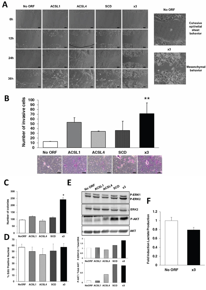 Combination of ACSL with SCD overexpression stimulates migration, invasion and colony formation without major effects on proliferation.