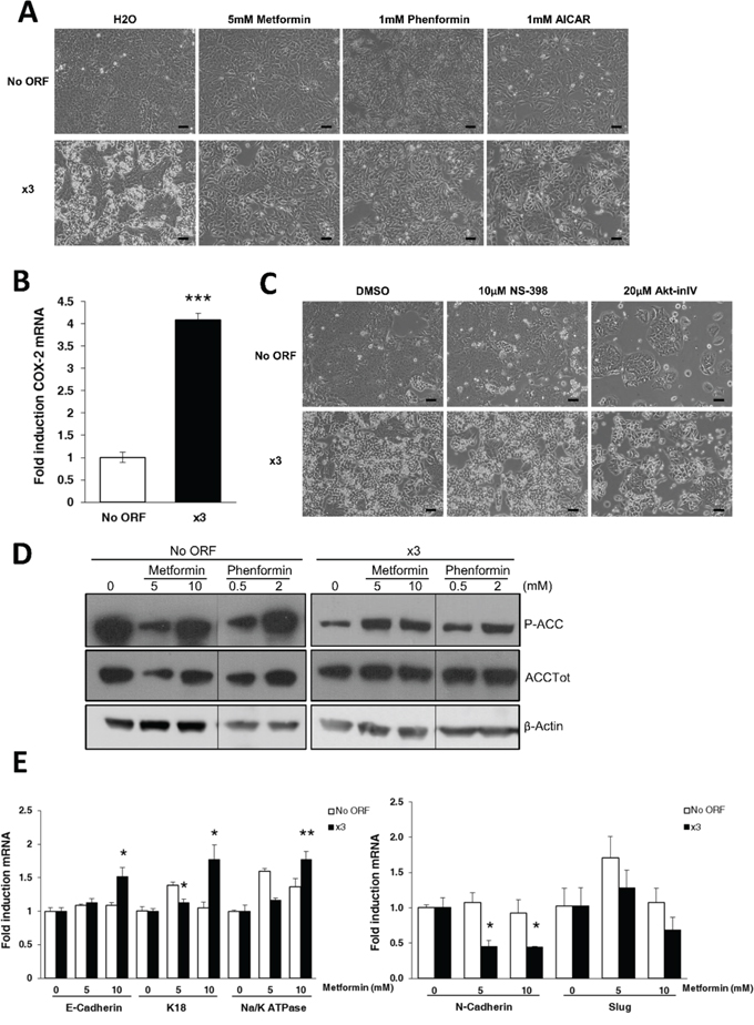 AMPK activation rescues normal DLD-1 epithelial phenotype.