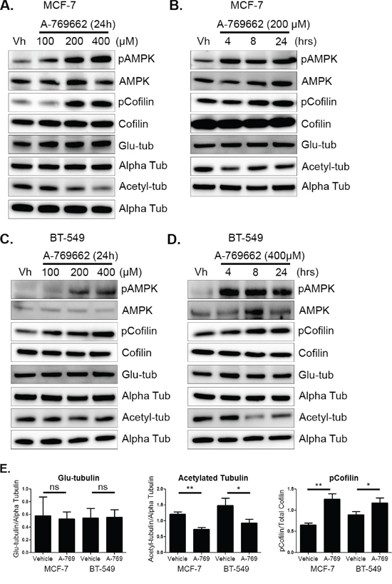 AMPK activation decreases cofilin activation and acetylated tubulin.