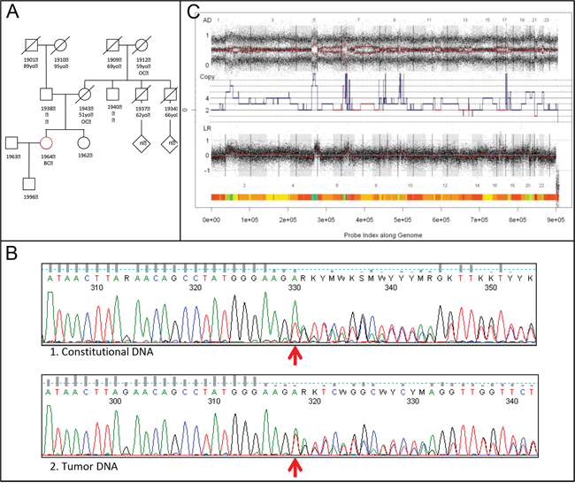 BRCA1 analyses and BRCAness.