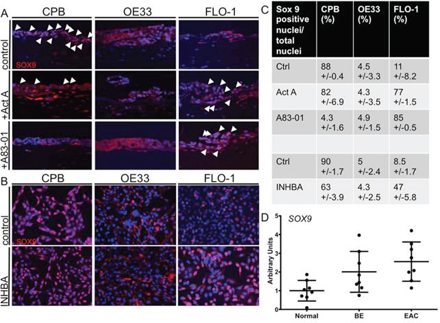 Activin A induces nuclear SOX9 in FLO-1 cells.