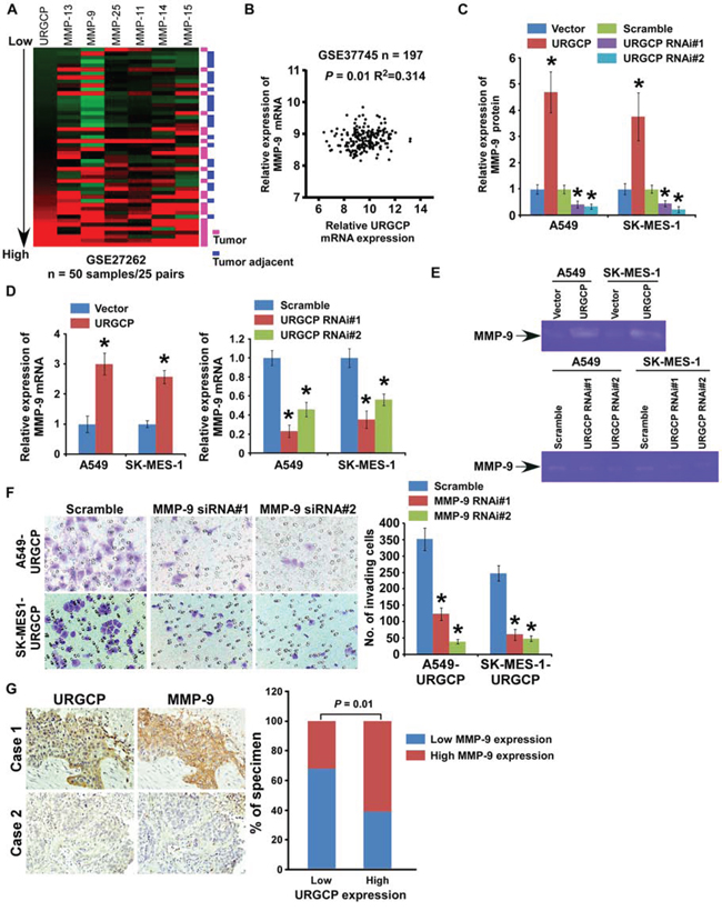 URGCP promotes the invasive ability of NSCLC cells through upregulation of MMP-9.