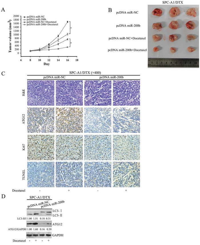 MiR-200b enhances the antitumor efficacy of docetaxel in vivo.