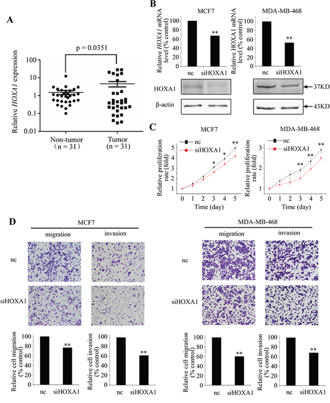 HOXA1 functions as an oncogene in breast cancer cells.