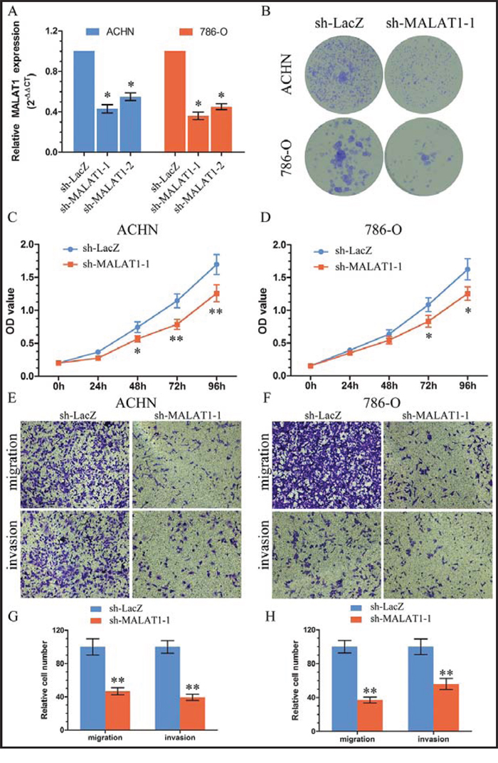 Knockdown of MALAT1 inhibited cell proliferation and metastasis in vitro.