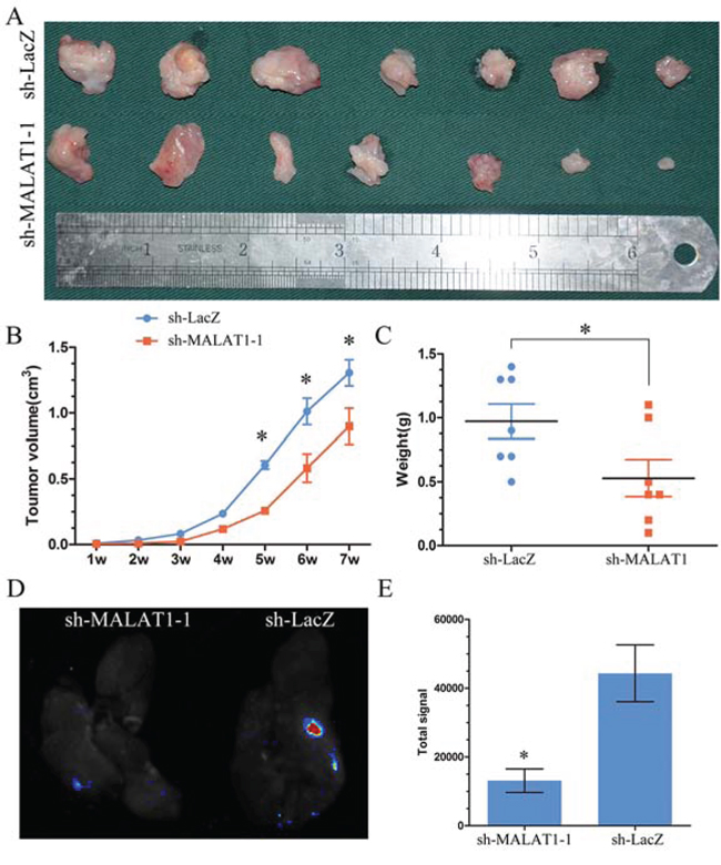 MALAT1 induced proliferation and metastsis in vivo.