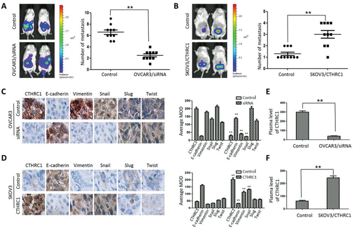 CTHRC1 promoted tumor metastasis by regulating EMT in vivo.