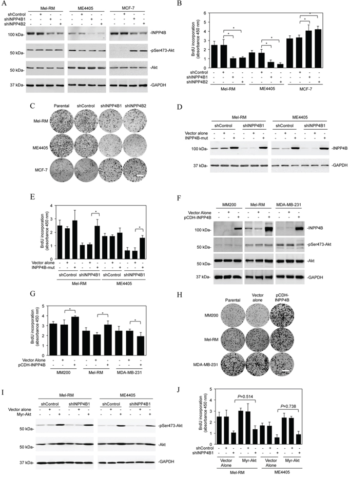 INPP4B promotes proliferation of melanoma cells independently of Akt.