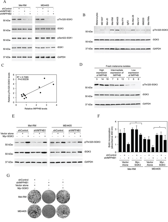 SGK3 is involved in INPP4B-mediated melanoma cell proliferation.
