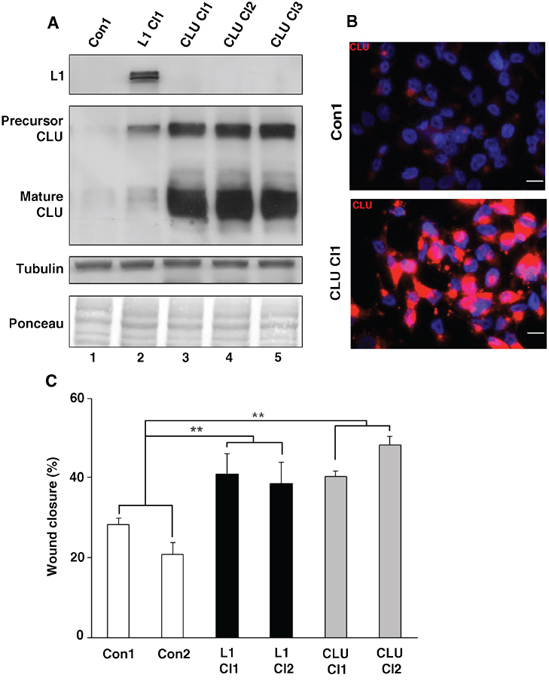 Modulation of CLU levels in CRC cells affects cell motility.