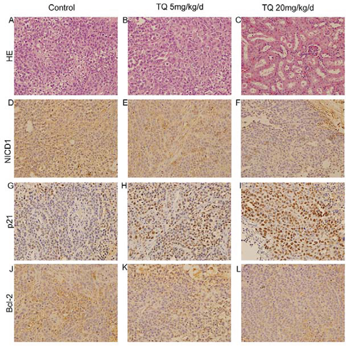 The anti-cancer effects of TQ on HCC in vivo.