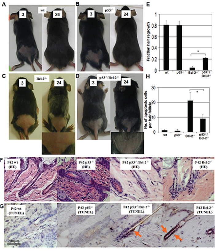 Hair regrowth in wild-type (wt), p53&#x2212;/&#x2212;, Bcl-2&#x2212;/&#x2212;/p53&#x2212;/&#x2212; and Bcl-2&#x2212;/&#x2212; mice.