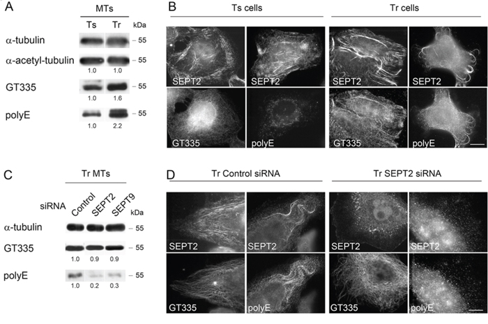 Septins are required to allow long chain polyglutamylation of microtubules in Tr cells.