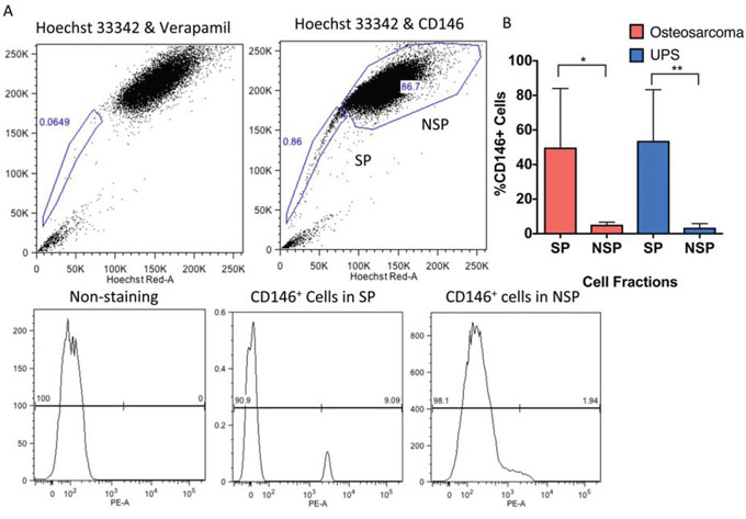 CD146 expression is enriched on the surface of SP cells in human UPS and osteosarcoma.