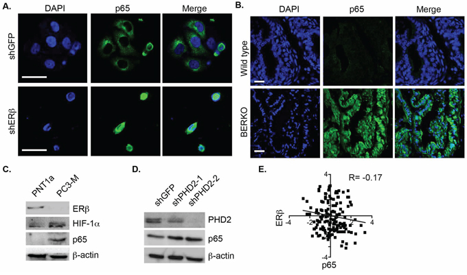 Analysis of ER&#x03B2; and p65 localization and expression in prostate cells and tissues.