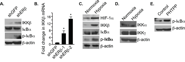 Regulation of IKK&#x03B2; and pI&#x03BA;B&#x03B1; expression by ER&#x03B2; and hypoxia.