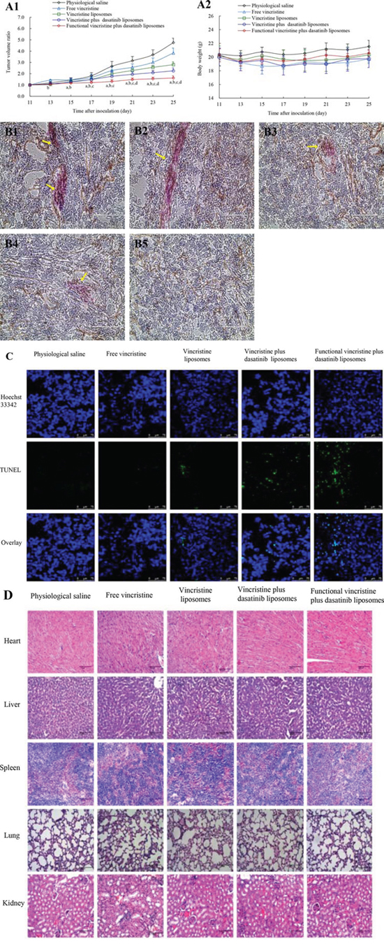 Antitumor efficacy in tumor-bearing nude mice xenografted with MDA-MB-231 cells after treatment with functional vincristine plus dasatinib liposomes.