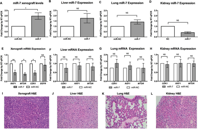 Systemic miR-7 therapy in vivo leads to inhibition of RAF1, MTOR and CDK1 without evidence of off-target effects.