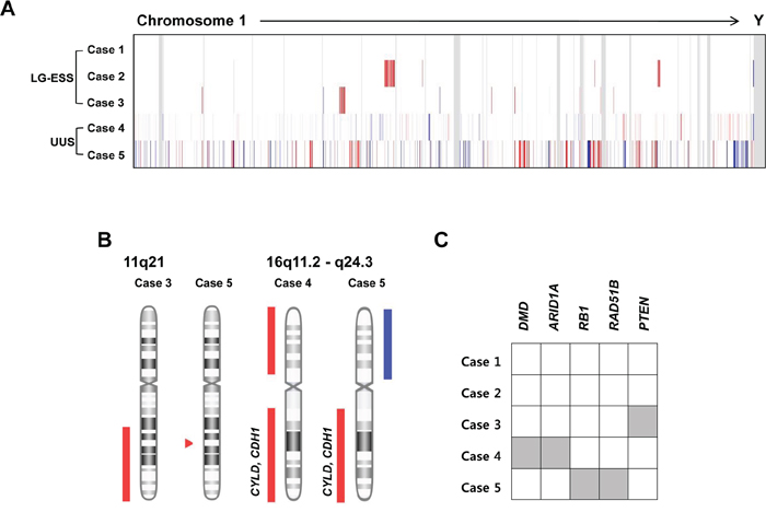 Copy number alteration (CNA) profiles of five endometrial stromal sarcomas.