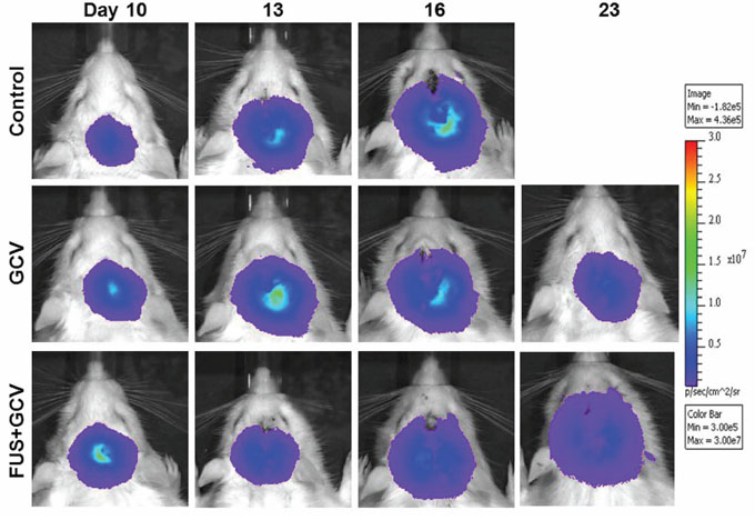 Biophotonic imaging of longitudinal brain tumor monitoring from days 10 to 23 after implantation.