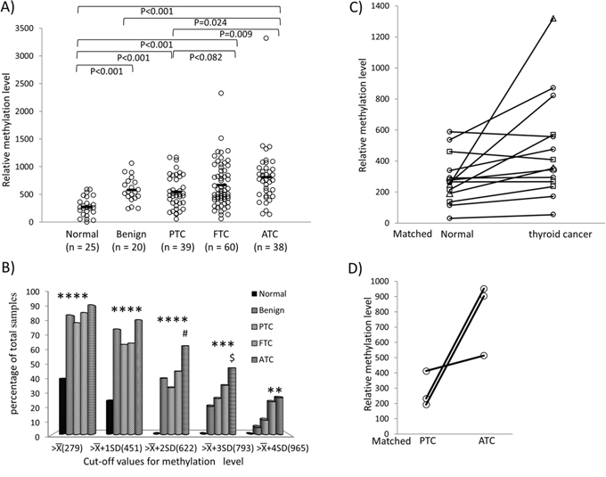 Methylation of REC8 in various thyroid tumors&#x2014;progression from low- to high-grade tumors.