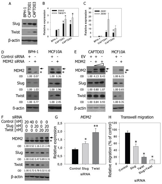 Regulation of Slug by MDM2 requires intact p53 function, while downregulation of Slug or Twist in CAFTD03 cells upregulates MDM2 and inhibits cell migration.