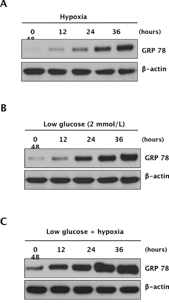 Expression of GRP78 under hypoxic and glucose-deprivation conditions in RCC cells.