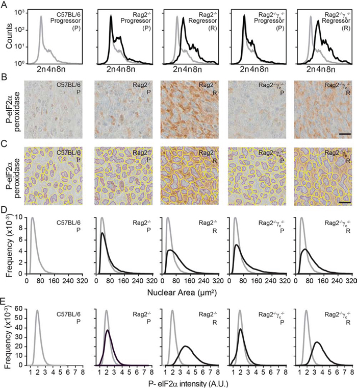 Morphometric analysis of ploidy and eIF2&alpha; phosphorylation on tumor tissue sections.