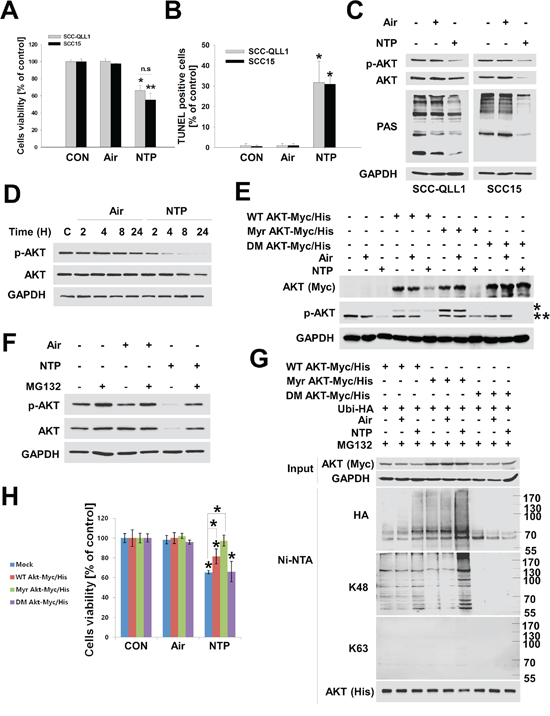 NTP induces cytotoxicity through K48-linked ubiquitination of active AKT in HNC cells.