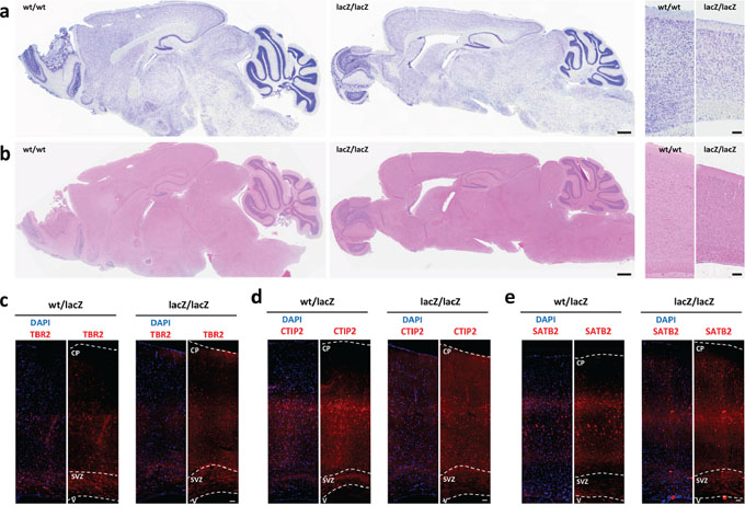 Loss of Usp22 in adult mouse brain results in impaired cortical differentiation.