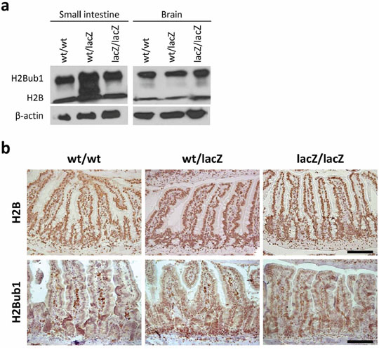 Differentiation defect is independent of H2B and H2Bub1 levels.