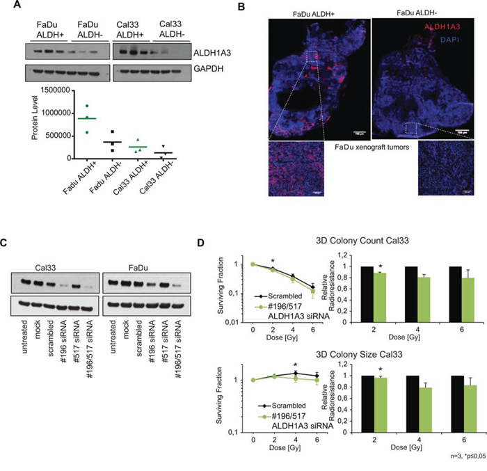 ALDH1A3 as radioresistance relevant enzyme.