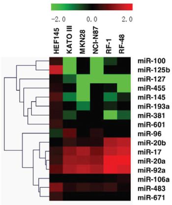 Alterations in miRNA expression profiles across 5 gastric cancer cell lines and 1 normal gastric cell line.