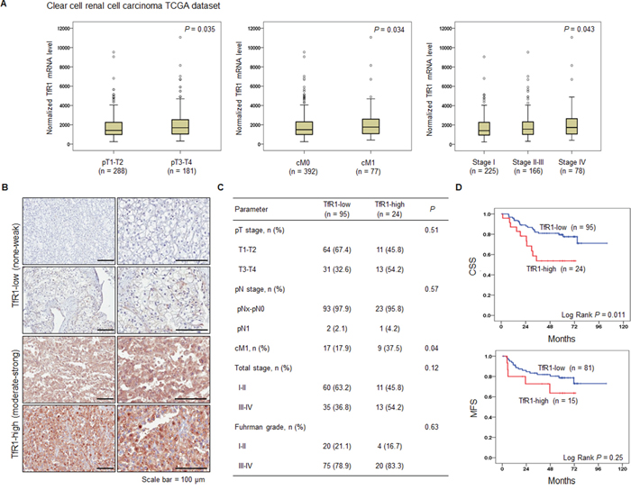 Upregulation of transferrin receptor 1 (TfR1) in human primary renal cell carcinoma (RCC) is correlated with distant metastasis and worse clinical outcomes.