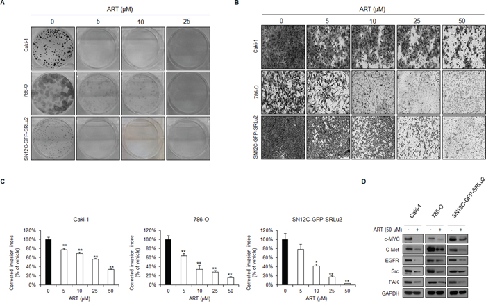 ART inhibits the colony forming and invasion abilities of human RCC cells in a dose dependent manner.