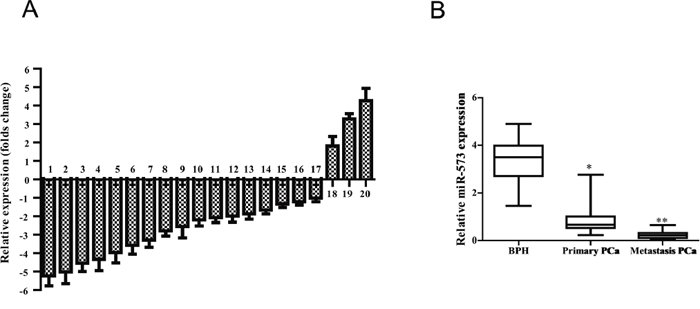 miR-573 level is decreased in human prostate cancer tissues.