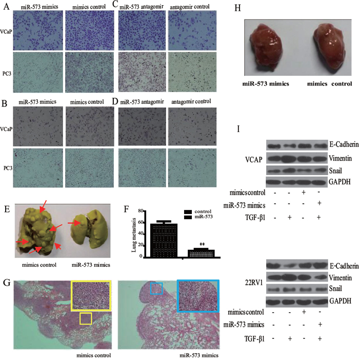 Effect of miR-573 on cell motility in vitro and and tumor metastasis in vivo.