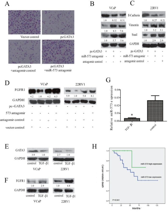 Association of miR-573 expression with FGFR1 and GATA3 in PCa.