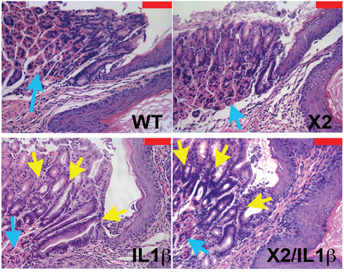 Histopathologic change in K14-Cdx2/L2-IL-1&#x03B2; double and L2-L-1&#x03B2; single transgenic mice.