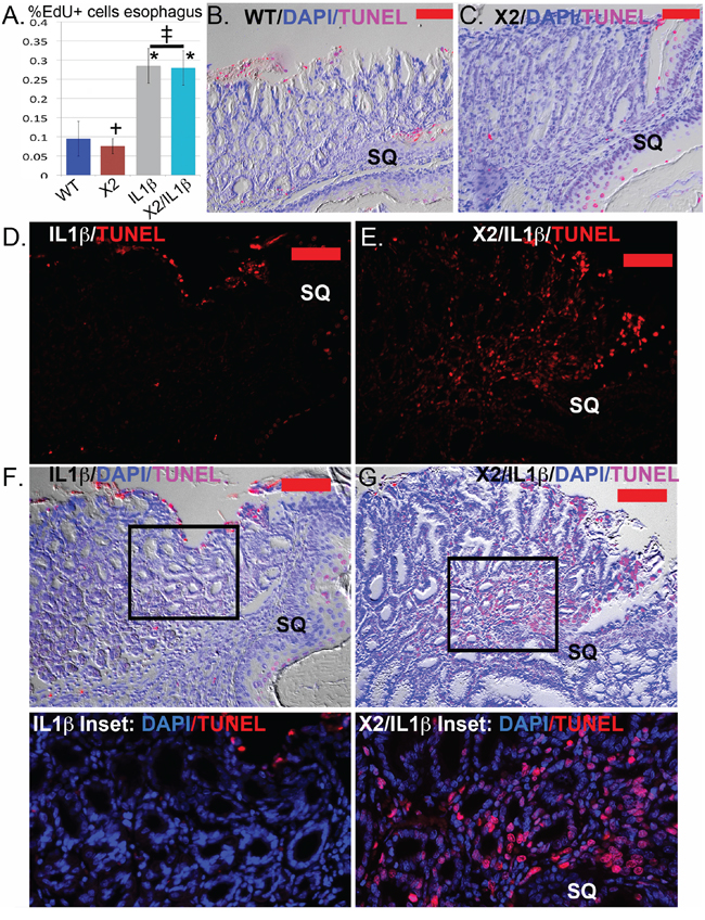 Apoptosis but not cell proliferation is significantly altered in the SCJ metaplasia K14-Cdx2::L2-IL-1&#x03B2; transgenic mice.