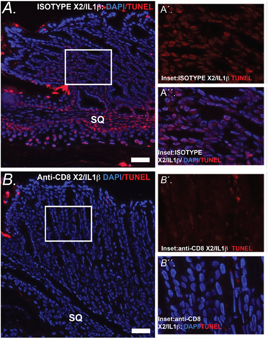 Apoptosis at the SCJ in K14-Cdx2::L2-IL-1&#x03B2; mice is lost with knockdown of CD8&#x002B; cells.