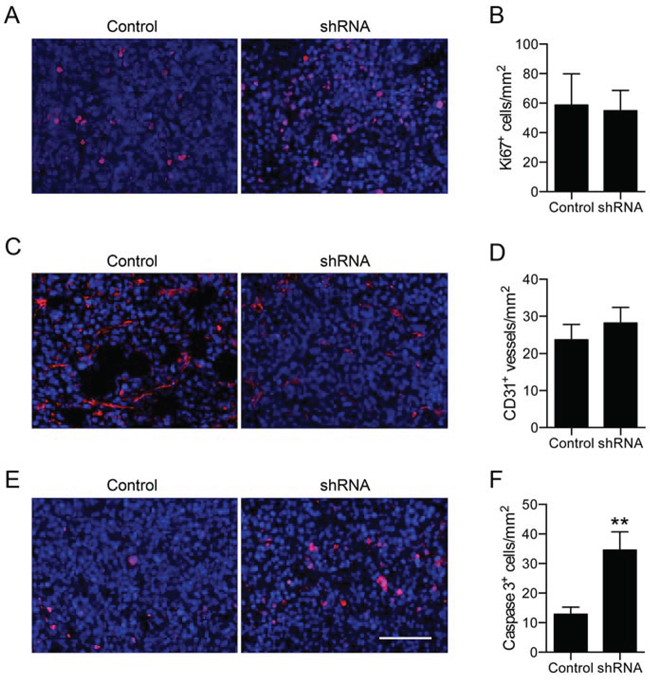 Effect of Nav1.5 on proliferation, apoptosis and angiogenesis.