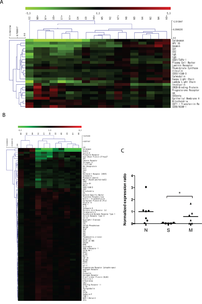 Differential protein expression identified by antibody microarray profiling.