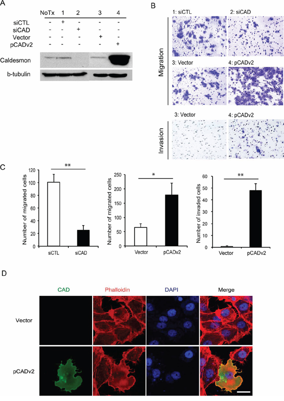 Migration and invasiveness of high-risk superficial bladder cancer (BC) cells following modulation of caldesmon (CAD) expression.