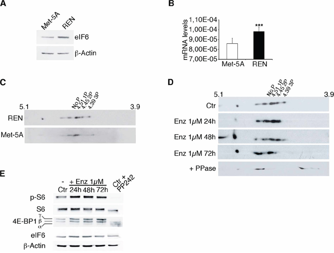 eIF6 hyperphosphorylation in REN cells is sensitive to Enzastaurin treatment.