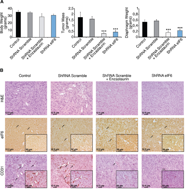 Enzastaurin administration and eIF6 depletion have a protective effect, in vivo.